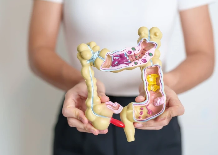 Problémy s hrubým črevom